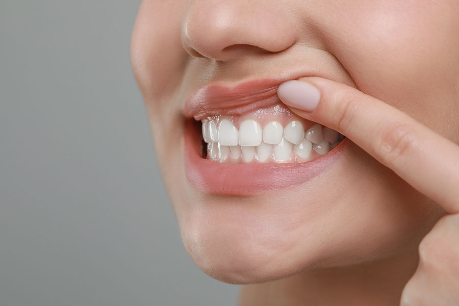 Oral Surgery (Tooth Extractions)