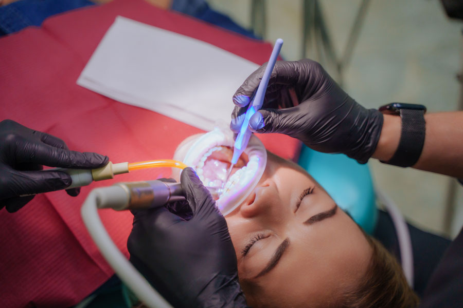 Root Canals